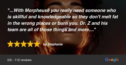 Google image review for Morpheus8 treatment in Beverly Hills