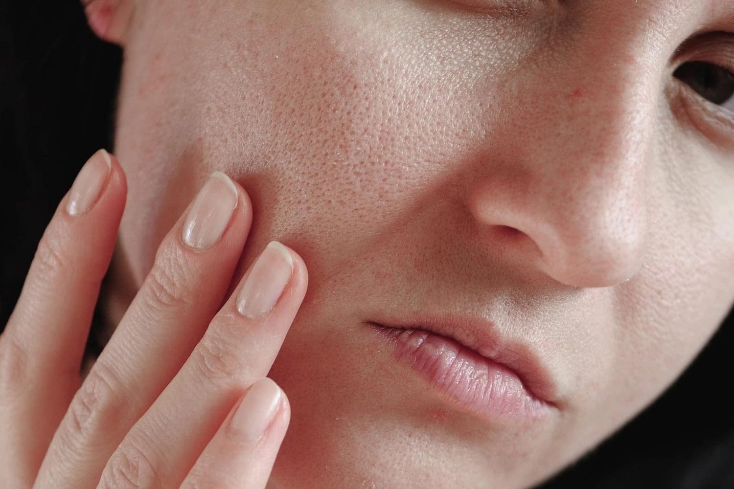 Enlarged Pores Treatment