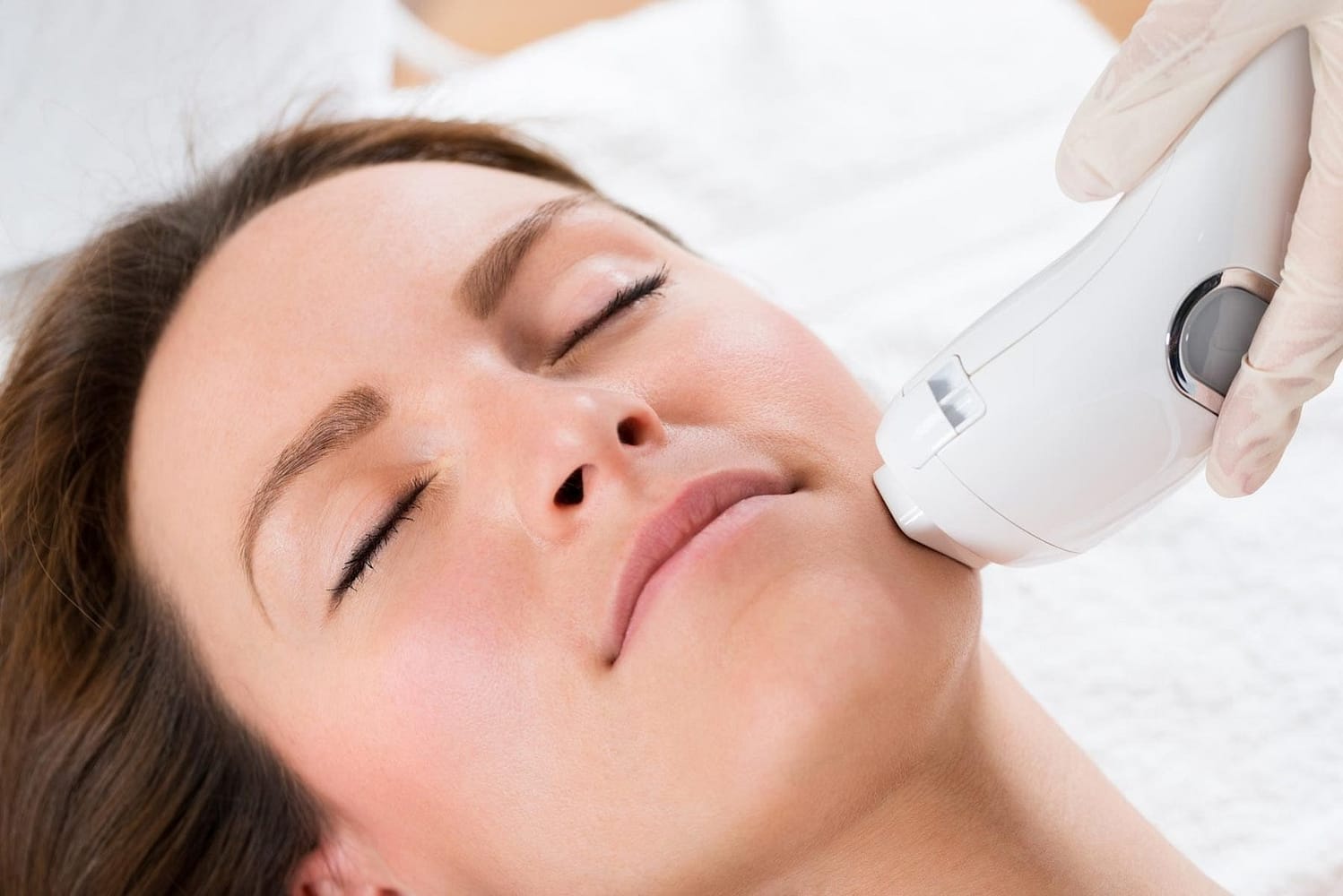 Ipl Face Treatment