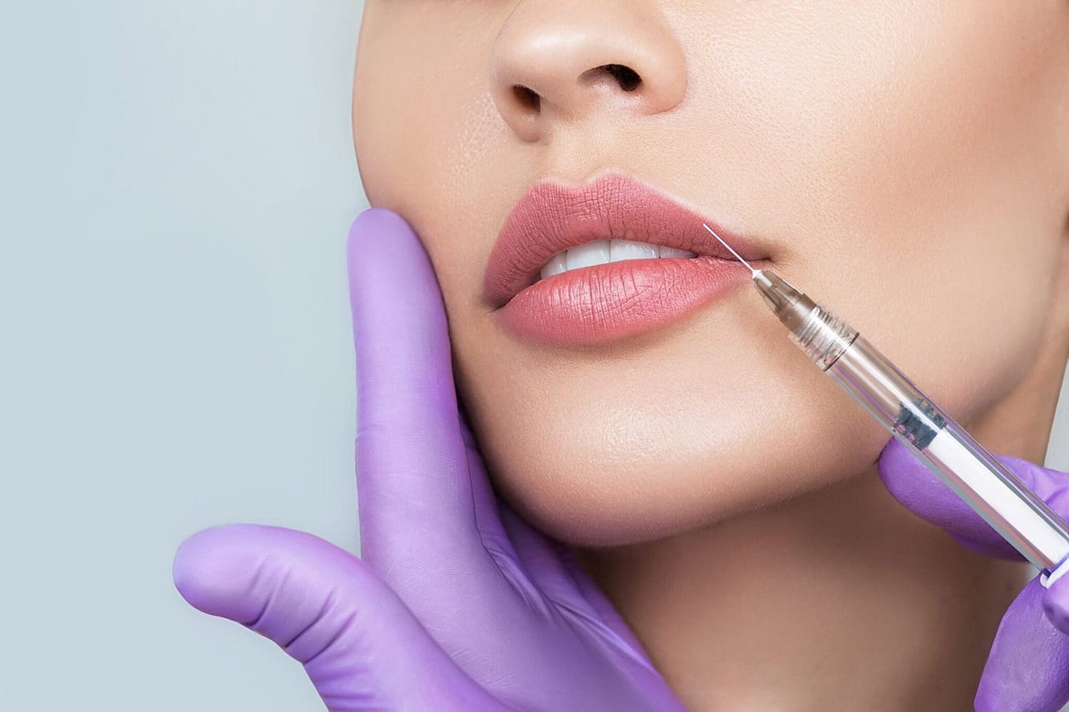 Lips Fillers