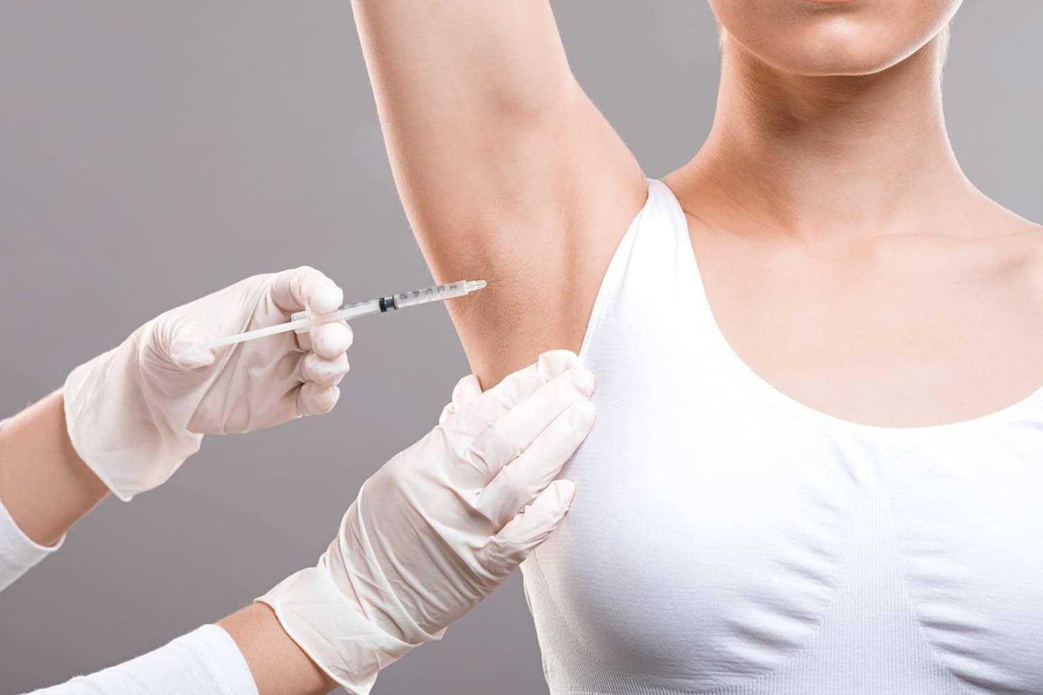 botox for hyperhidrosis