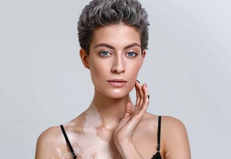 skin-pigmentation
