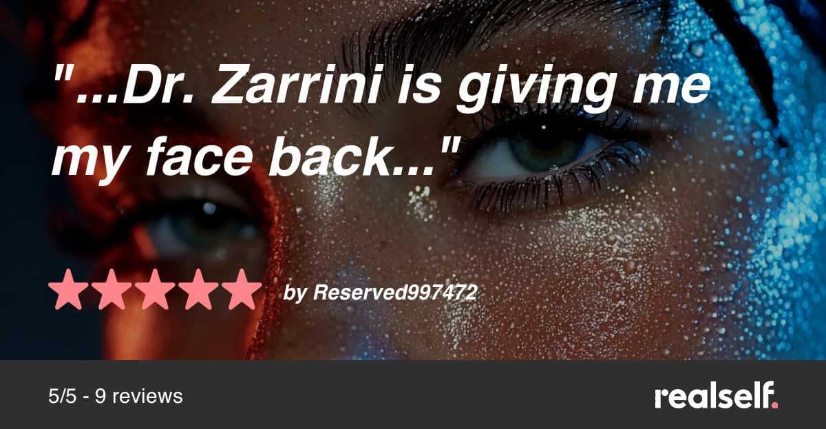 Dr-Zarrini-Gave-me-my-Face-Back-Review