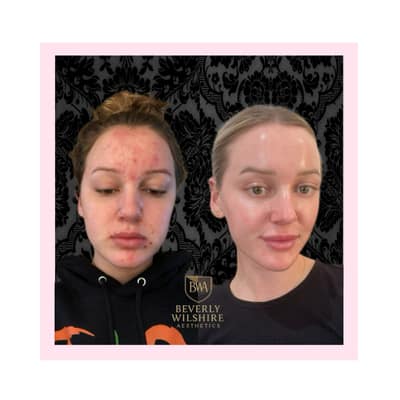 Supreme Skin™ revealed at BWA