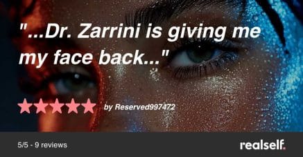 Dr-Zarrini-Gave-me-my-Face-Back-Review