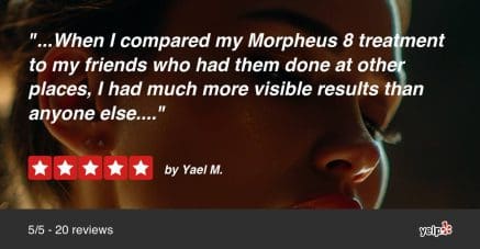 Yael-Best-Morpheus8-Review